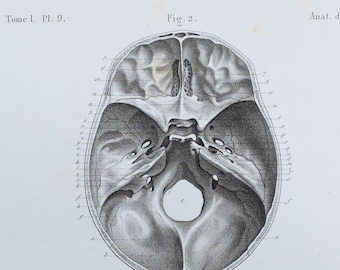 Human Skull - RARE ORIGINAL PRINT from Atlas d'Anatomie descriptive du corps humain C. Bonamy - Paris 1866