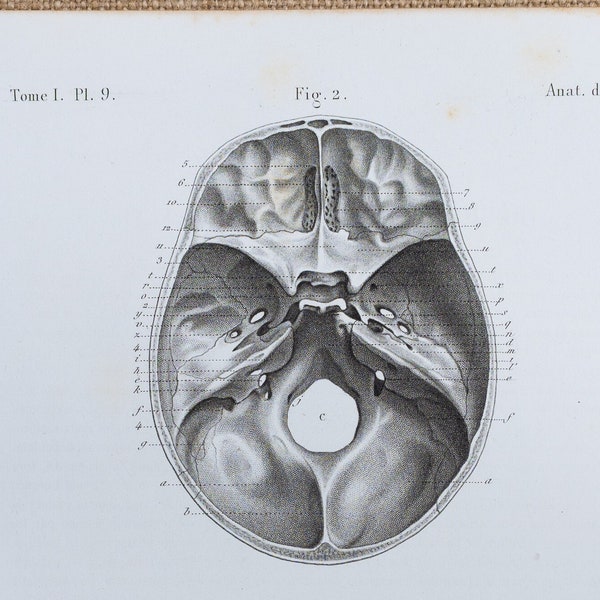 Human Skull - RARE ORIGINAL PRINT from Atlas d'Anatomie descriptive du corps humain C. Bonamy - Paris 1866