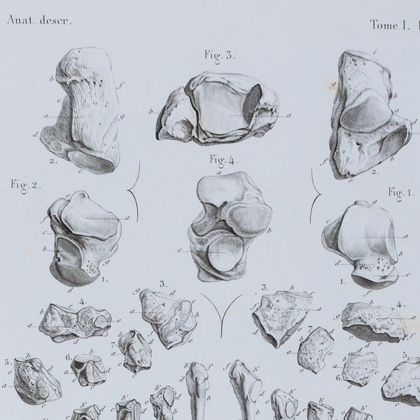 Foot Bones - RARE ORIGINAL PRINT from Atlas d'Anatomie descriptive du corps humain C. Bonamy - Paris 1866