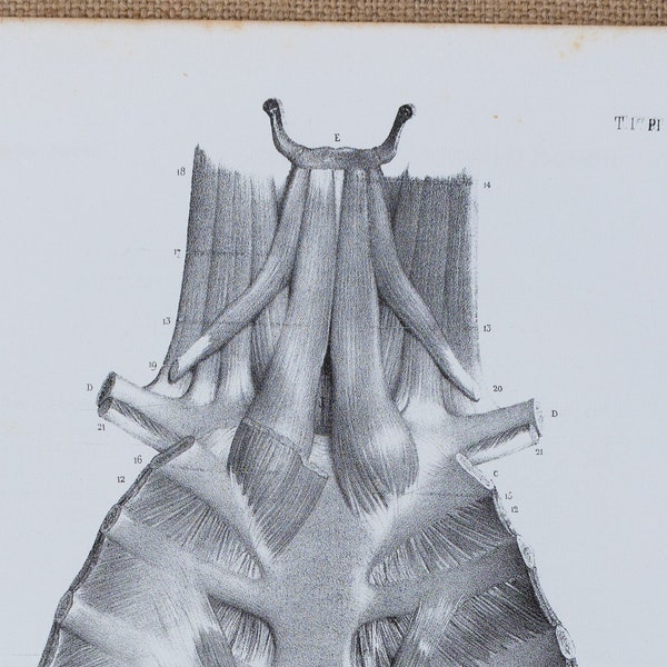 Triangular Sternum Muscle - RARE ORIGINAL PRINT from Atlas d'Anatomie descriptive du corps humain C. Bonamy - Paris 1866