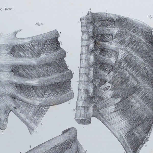 Internal and External Intercostal Muscles - RARE ORIGINAL PRINT from Atlas d'Anatomie descriptive du corps humain C. Bonamy - Paris 1866