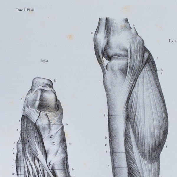 Internal Leg and Dorsal Foot Muscles - RARE ORIGINAL PRINT from Atlas d'Anatomie descriptive du corps humain C. Bonamy - Paris 1866