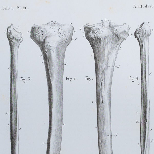 Leg Bones - RARE ORIGINAL PRINT from Atlas d'Anatomie descriptive du corps humain C. Bonamy - Paris 1866