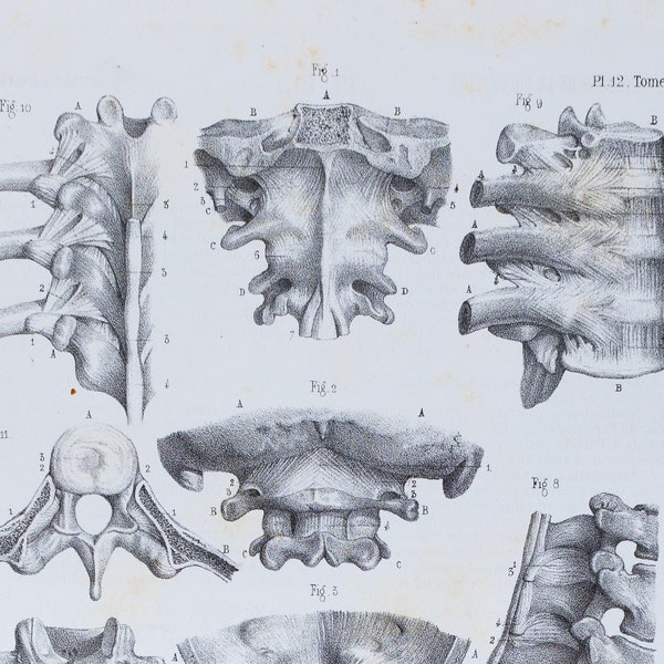 Cerebrospinal Joint - RARE ORIGINAL PRINT from Atlas d'Anatomie descriptive du corps humain C. Bonamy - Paris 1866