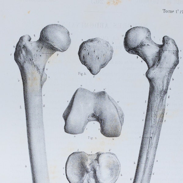 Thigh Bones - RARE ORIGINAL PRINT from Atlas d'Anatomie descriptive du corps humain C. Bonamy - Paris 1866