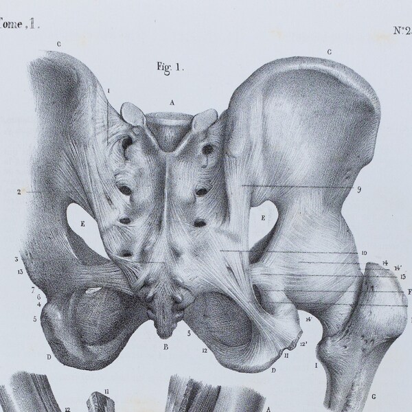 Knee Joints - RARE ORIGINAL PRINT from Atlas d'Anatomie descriptive du corps humain C. Bonamy - Paris 1866