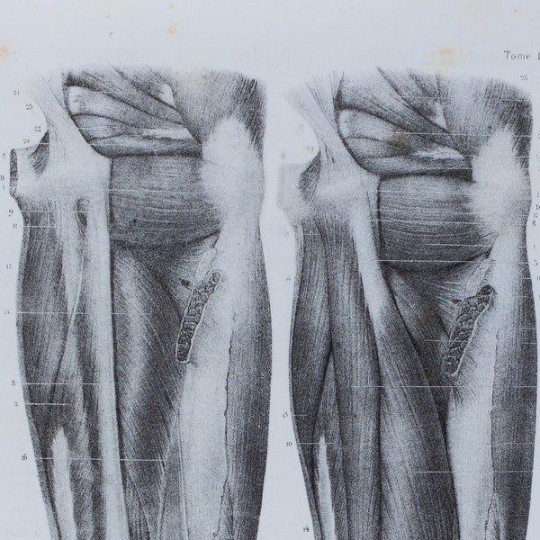 Posterior Femoral: Quadratus Femoris Muscle - RARE ORIGINAL PRINT from Atlas d'Anatomie descriptive du corps humain C. Bonamy - Paris 1866
