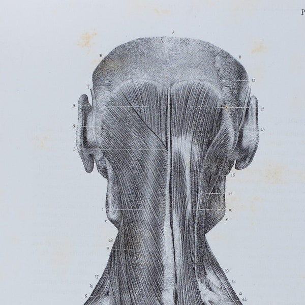 Posterior Trunk Muscle - Third Layer - RARE ORIGINAL PRINT from Atlas d'Anatomie descriptive du corps humain C. Bonamy - Paris 1866