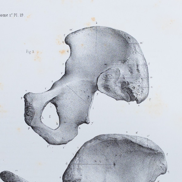 Coxal Bones - RARE ORIGINAL PRINT from Atlas d'Anatomie descriptive du corps humain C. Bonamy - Paris 1866