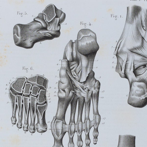 Foot Joints - RARE ORIGINAL PRINT from Atlas d'Anatomie descriptive du corps humain C. Bonamy - Paris 1866