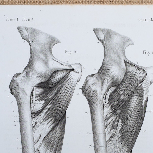 Pectineus and External Shutter Muscles - RARE ORIGINAL PRINT from Atlas d'Anatomie descriptive du corps humain C. Bonamy - Paris 1866