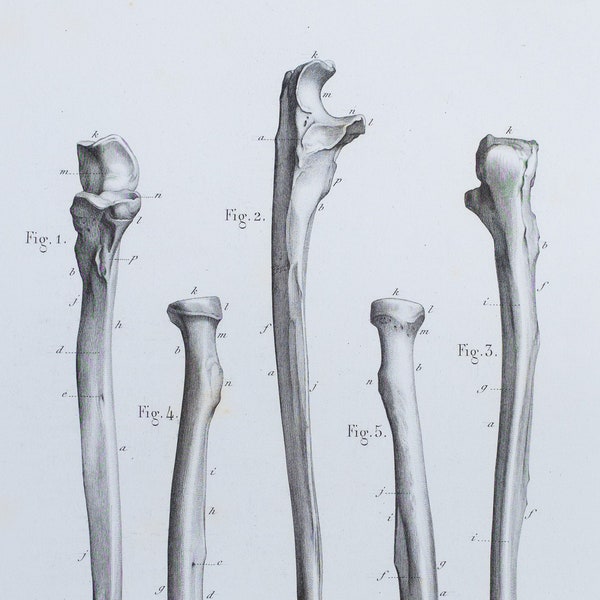 Forearm Bones- RARE ORIGINAL PRINT from Atlas d'Anatomie descriptive du corps humain C. Bonamy - Paris 1866