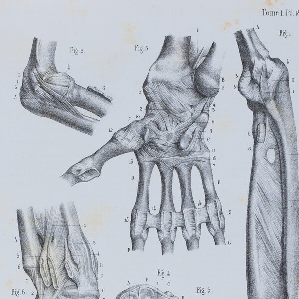 Elbow, Forearm and Hand Joints - RARE ORIGINAL PRINT from Atlas d'Anatomie descriptive du corps humain C. Bonamy - Paris 1866