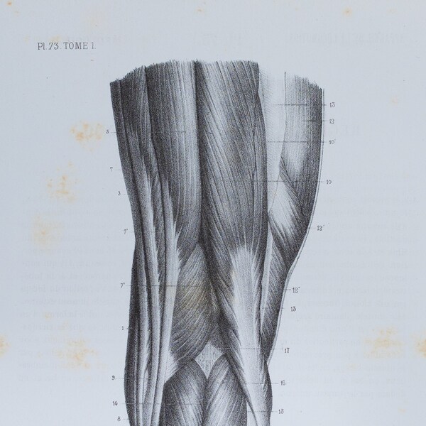 Posterior Knee Muscles - RARE ORIGINAL PRINT from Atlas d'Anatomie descriptive du corps humain C. Bonamy - Paris 1866