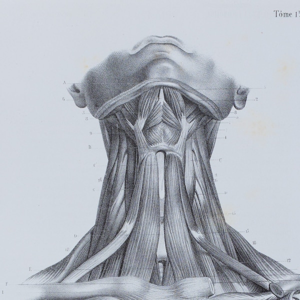 Anterior Neck Muscles - RARE ORIGINAL PRINT from Atlas d'Anatomie descriptive du corps humain C. Bonamy - Paris 1866