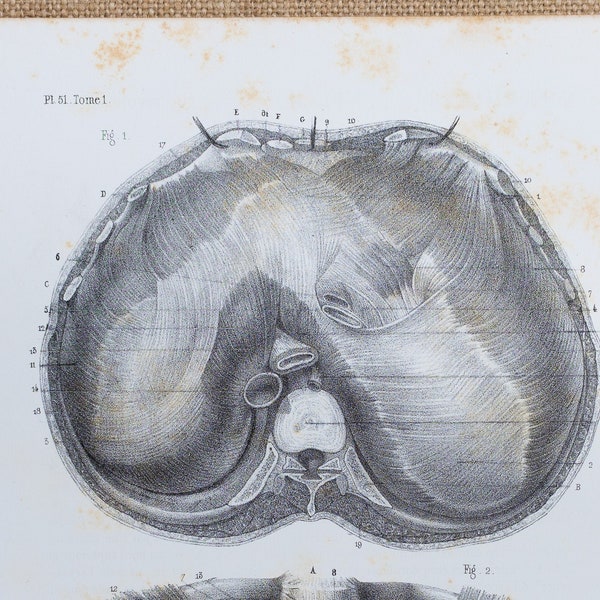 Superior Side of the Diaphragm - RARE ORIGINAL PRINT from Atlas d'Anatomie descriptive du corps humain C. Bonamy - Paris 1866
