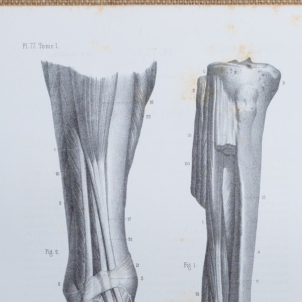 Anterior Leg Muscles - RARE ORIGINAL PRINT from Atlas d'Anatomie descriptive du corps humain C. Bonamy - Paris 1866