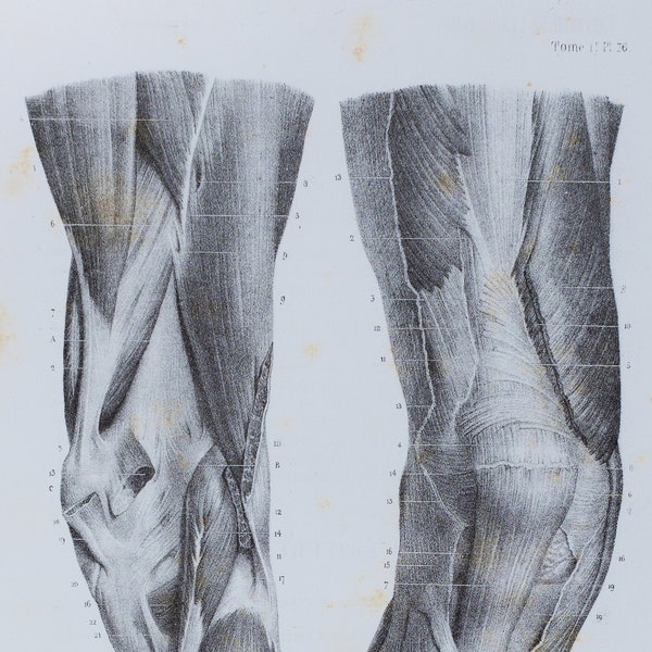 Anterior and Posterior Knee Muscles - RARE ORIGINAL PRINT from Atlas d'Anatomie descriptive du corps humain C. Bonamy - Paris 1866