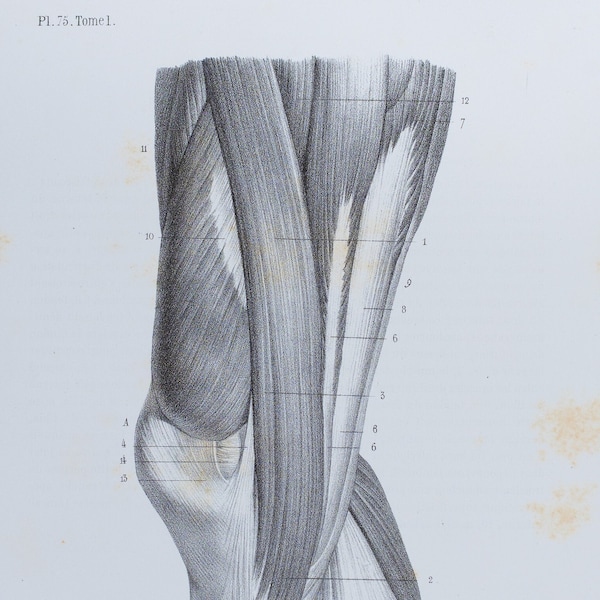 Internal Knee Muscles - RARE ORIGINAL PRINT from Atlas d'Anatomie descriptive du corps humain C. Bonamy - Paris 1866