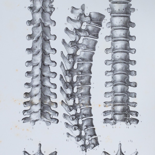 Dorsal vertebrae anatomy - RARE ORIGINAL PRINT from Atlas d'Anatomie descriptive du corps humain C. Bonamy - Paris 1866