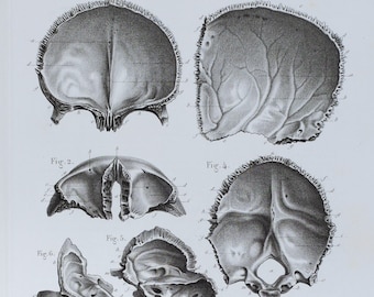 Head Bones  - RARE ORIGINAL PRINT from Atlas d'Anatomie descriptive du corps humain C. Bonamy - Paris 1866