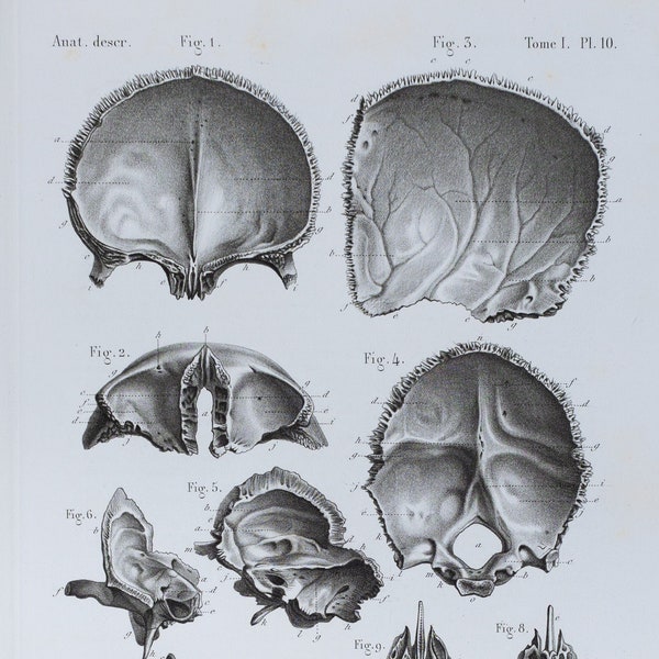 Head Bones  - RARE ORIGINAL PRINT from Atlas d'Anatomie descriptive du corps humain C. Bonamy - Paris 1866