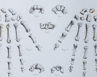 Hand Bones - RARE ORIGINAL PRINT from Atlas d'Anatomie descriptive du corps humain C. Bonamy - Paris 1866