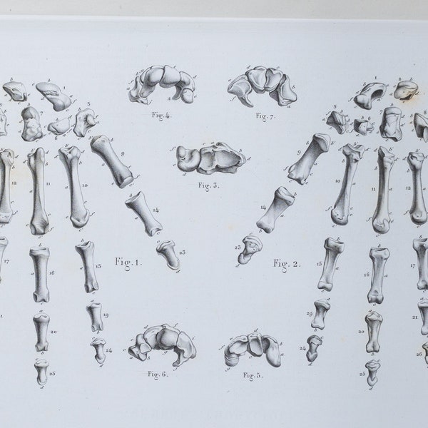 Hand Bones - RARE ORIGINAL PRINT from Atlas d'Anatomie descriptive du corps humain C. Bonamy - Paris 1866