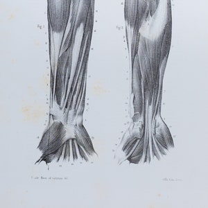 Hand arm muscle anatomy - RARE ORIGINAL PRINT from Atlas d&#39;Anatomie descriptive du corps humain C. Bonamy - Paris 1866