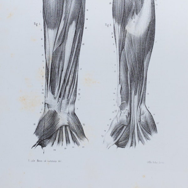 Hand arm muscle anatomy - RARE ORIGINAL PRINT from Atlas d'Anatomie descriptive du corps humain C. Bonamy - Paris 1866