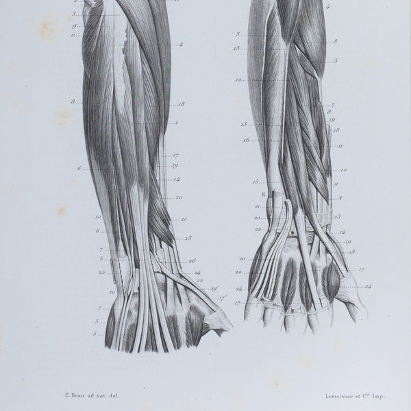 Hand arm muscle anatomy - RARE ORIGINAL PRINT from Atlas d'Anatomie descriptive du corps humain C. Bonamy - Paris 1866