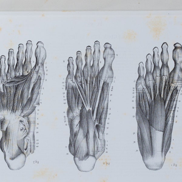 Muscles of the Foot - RARE ORIGINAL PRINT from Atlas d'Anatomie descriptive du corps humain C. Bonamy - Paris 1866
