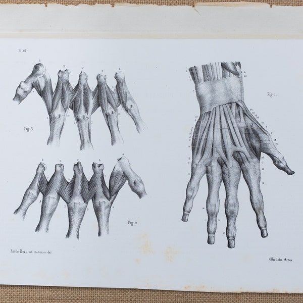 Hand anatomy - RARE ORIGINAL PRINT from Atlas d'Anatomie descriptive du corps humain C. Bonamy - Paris 1866