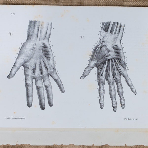 Hand anatomy - RARE ORIGINAL PRINT from Atlas d'Anatomie descriptive du corps humain C. Bonamy - Paris 1866