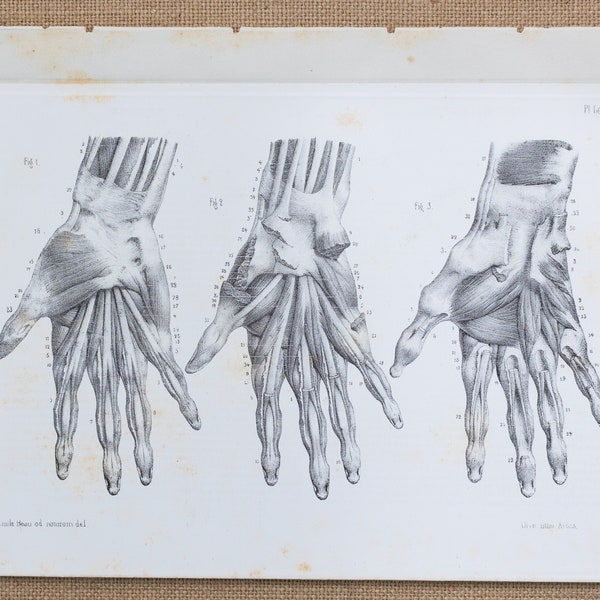 Hand anatomy - RARE ORIGINAL PRINT from Atlas d'Anatomie descriptive du corps humain C. Bonamy - Paris 1866
