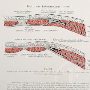 Könnte beinhalten: Eine detaillierte anatomische Illustration der menschlichen Bauchmuskeln, die den geraden Bauchmuskel, den äußeren schrägen Bauchmuskel, den inneren schrägen Bauchmuskel und den querverlaufenden Bauchmuskel zeigt. Die Abbildung enthält Beschriftungen für jeden Muskel und seine Sehnen sowie die Fascia transversalis und die Linea alba.