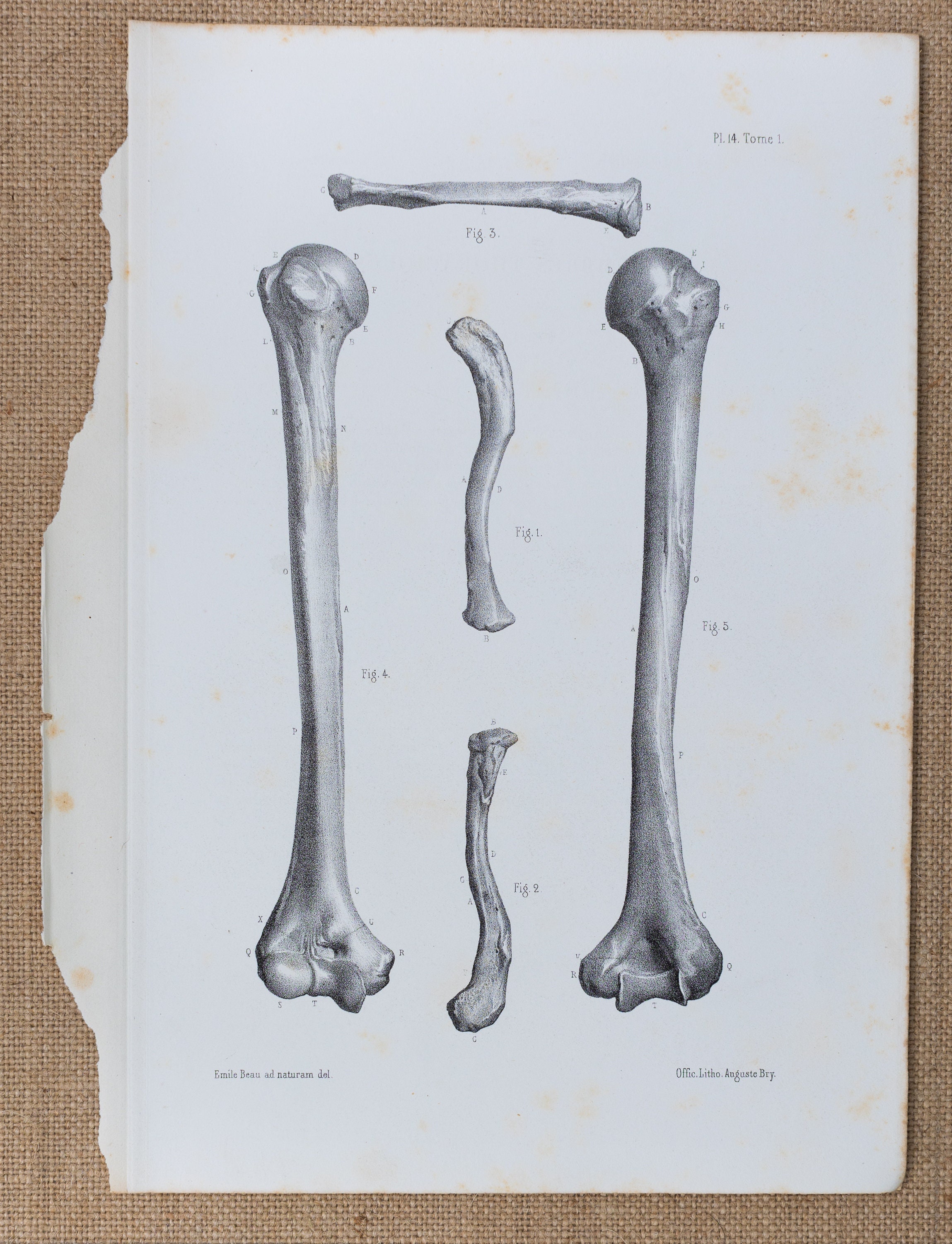 Arm Bones RARE ORIGINAL PRINT From Atlas D'anatomie Etsy