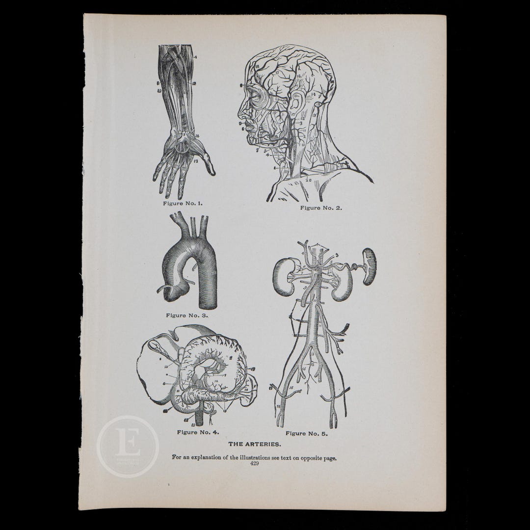 1901 ARTERIES of the BODY - Interaction Human Anatomy -original ...
