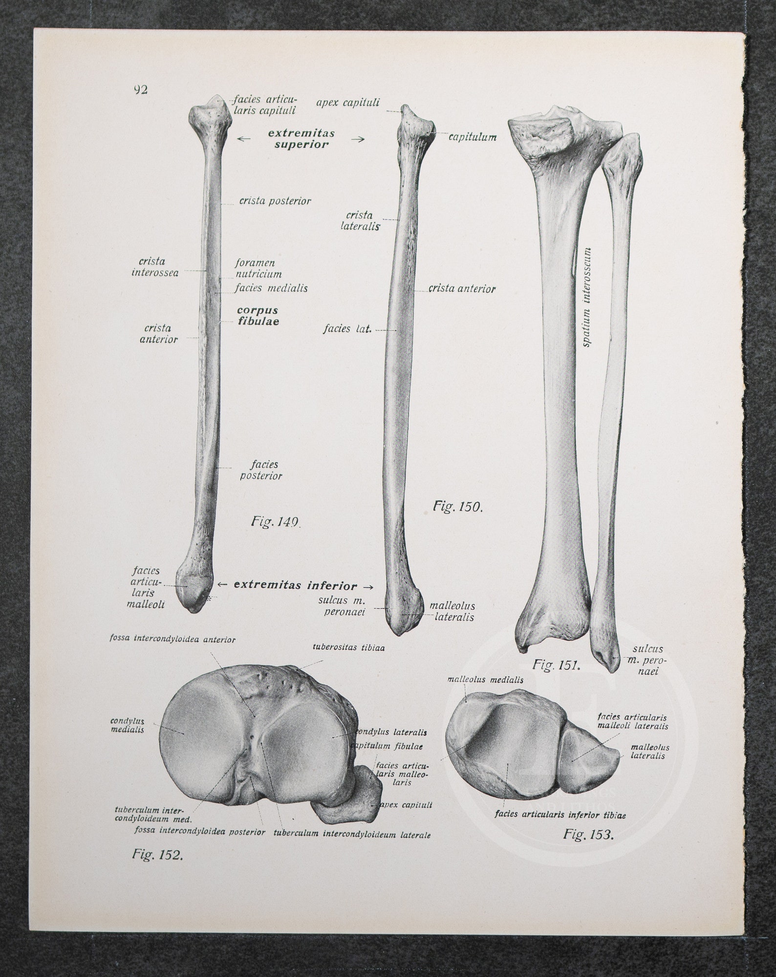 Tibia/fibula R Leg Leg Bones: Tibia / Fibula /human Anatomy - Descriptive Anatomy Book ...