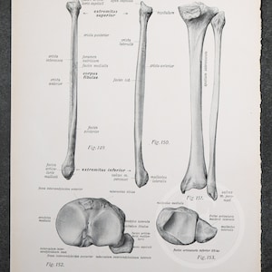 Leg Bones: Tibia / Fibula /human Anatomy - Descriptive Anatomy Book ...