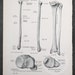 Leg Bones: Tibia / Fibula /human Anatomy - Descriptive Anatomy Book ...