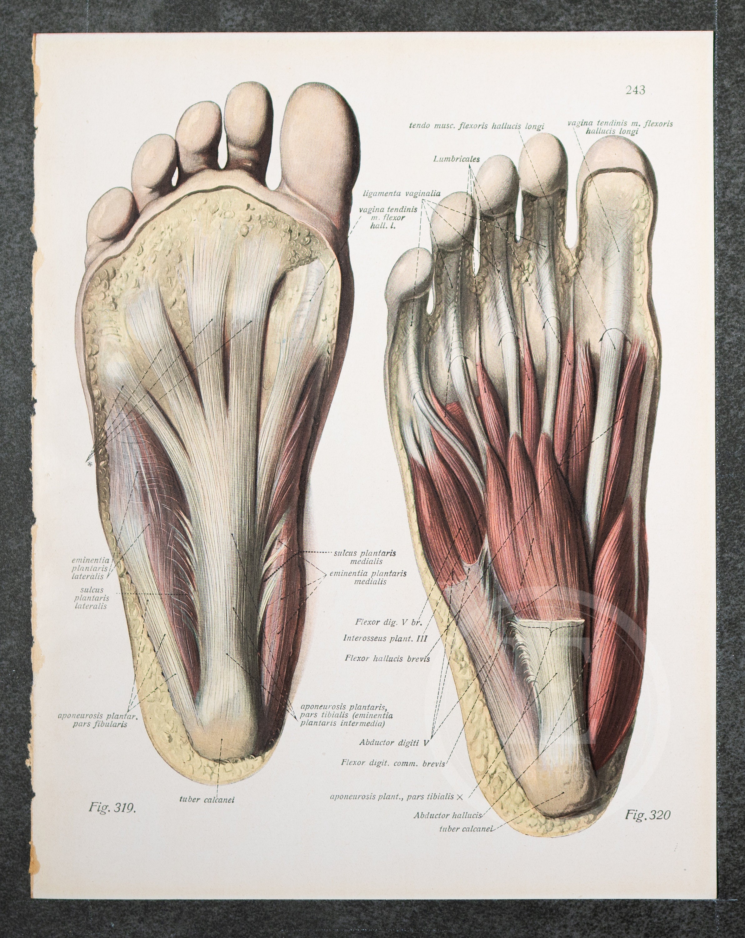 Anatomía De La Planta Del Pie Qué Es La Capsulitis En El Pie?