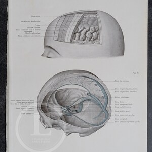 The different layers of the cranial vault - Human Anatomy - Topographyc Anatomy Book 1905 - Rare Lithography