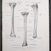 Leg Bones: Tibia / Fibula /human Anatomy - Descriptive Anatomy Book ...