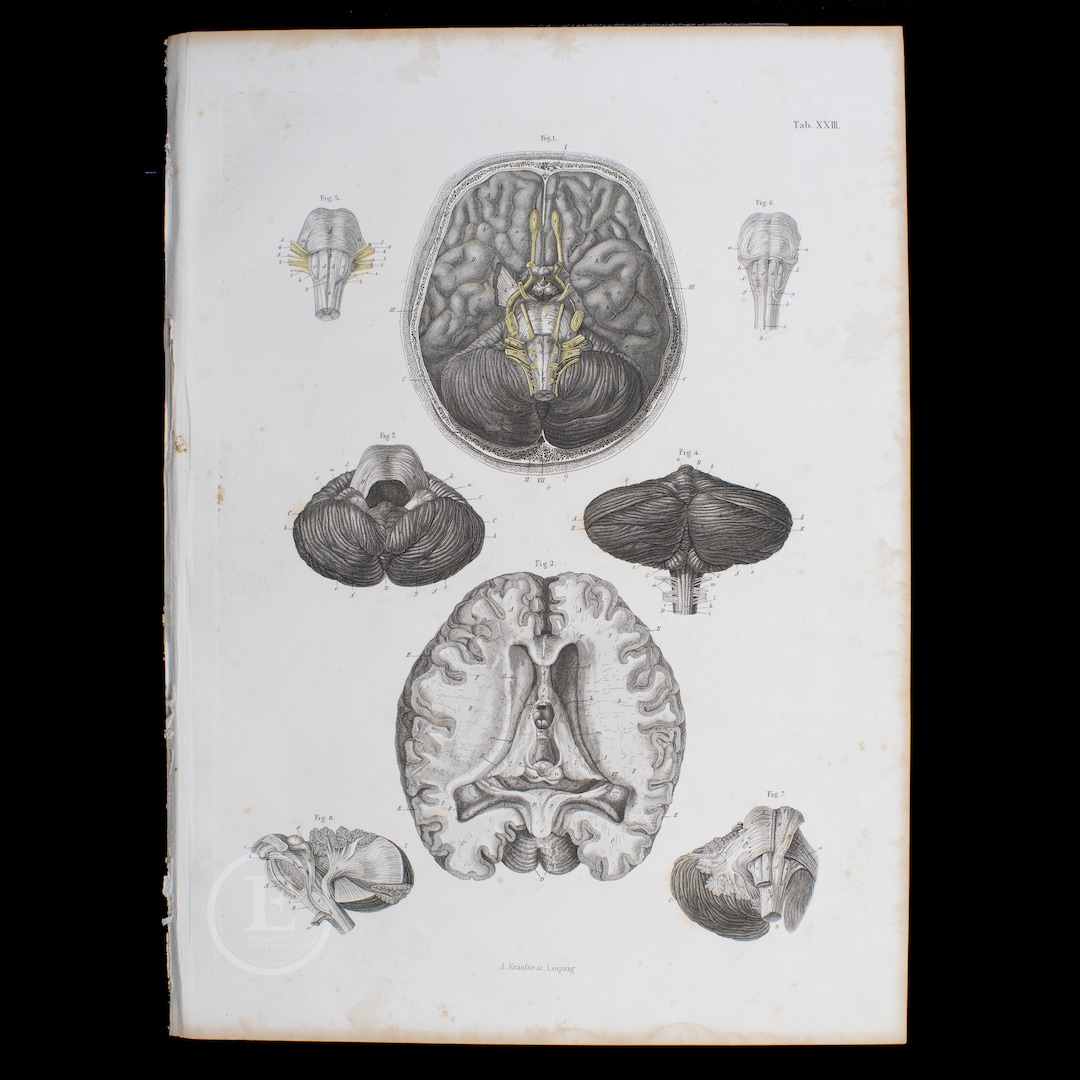 1860 Brain and Cerebellum – Hand-colored Steel Engraving From an Atlas ...