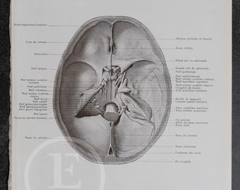 Lámina rara de anatomía del cráneo: nervios craneales (del libro de 1905).