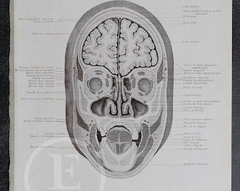 Litografía anatómica antigua, sección frontal de la cabeza (ilustración médica de 1905)