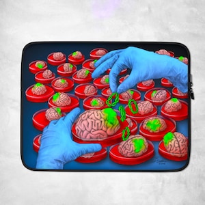 Puede incluir: Primer plano de una escena de laboratorio con múltiples placas de Petri que contienen cerebros. Los cerebros son rosados y tienen acentos verdes. Dos manos enguantadas manipulan una cadena verde. El texto "Briden 2018" está en la esquina inferior derecha.