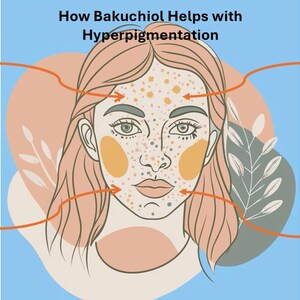 How Bakuchiol Helps with Hyperpigmentation