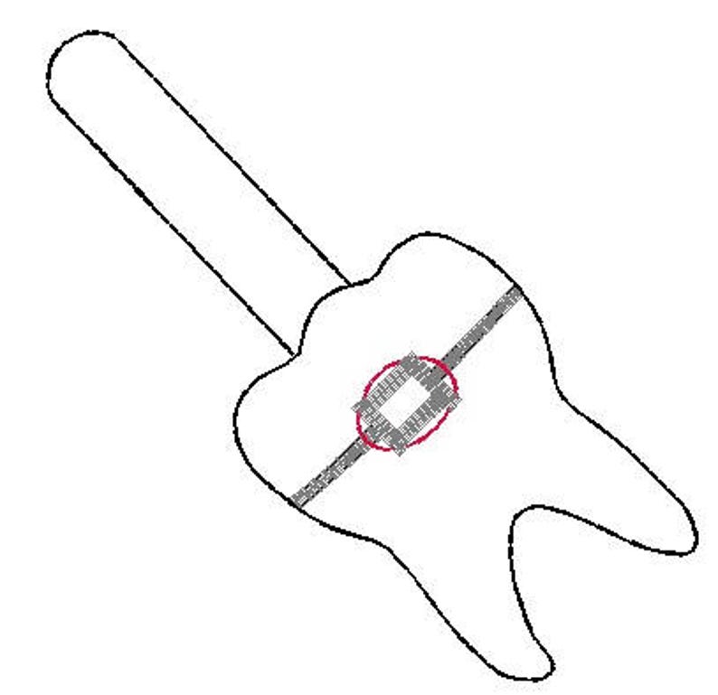 Orthodontist Dentist Braces Key Fob Snap Tab Embroidery Design Etsy